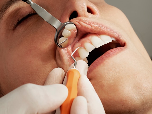 Do I Really Need a Tooth Extraction Signs It’s Time to See a Dentist