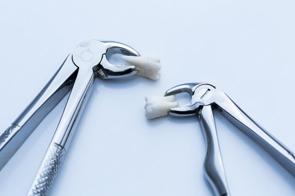 How to Prepare for Your First Tooth Extraction | Lee Dental & Facial