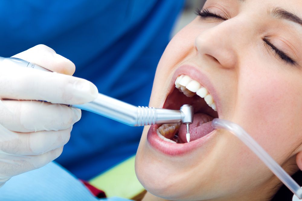 Dental Cleanings