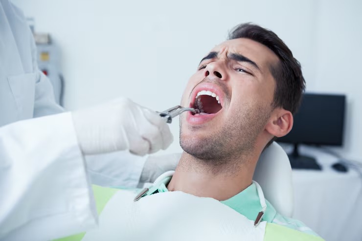 How to prepare for a tooth extraction a step by step patient guide